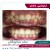 ارتودنسی دندان در کرج
