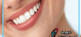همه چیز در مورد کامپوزیت دندان