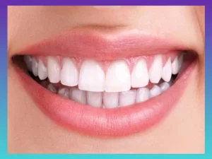 روکش دندان در کرج