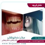 دندان قروچه