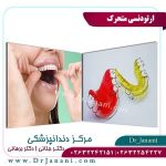 ارتودنسی متحرک