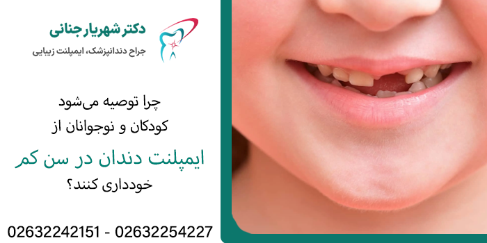 حداقل سن برای شروع ایمپلنت دندان