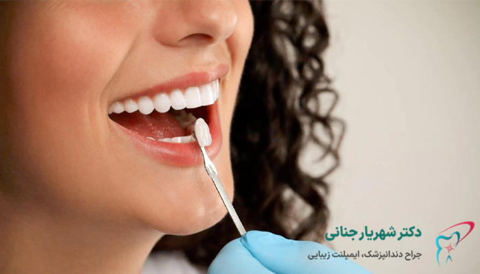 مراقبت های چند روز اول بعد از ایمپلنت دندان