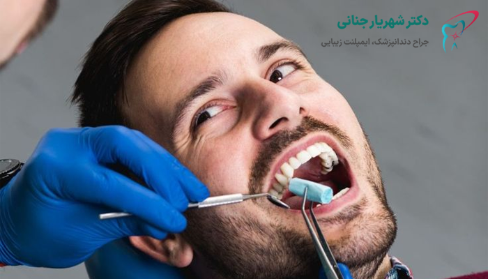 چه مدت بعد از کشیدن دندان باید ایمپلنت کرد؟