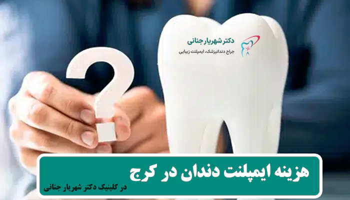 هزینه ایمپلنت دندان در کلینیک دکتر جنانی