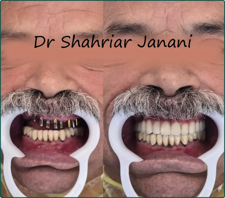 نمونه کار دکتر جنانی 10