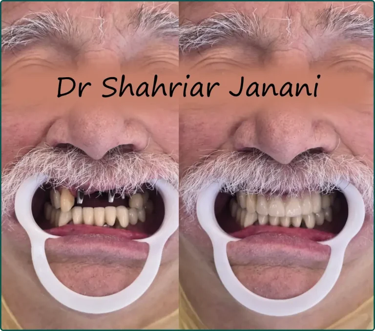 نمونه کار دکتر جنانی 12