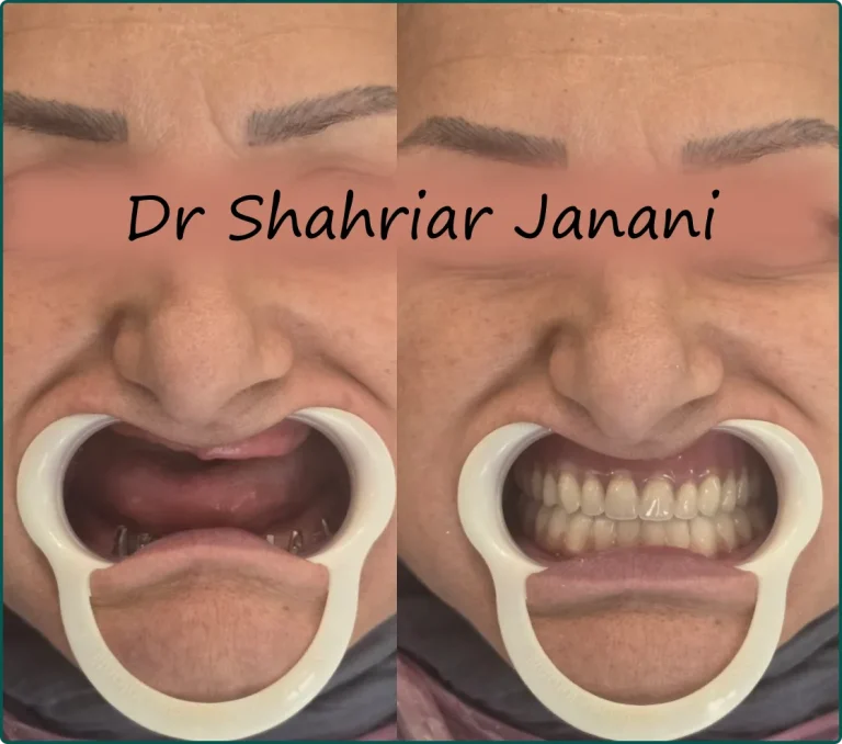 نمونه کار دکتر جنانی 13
