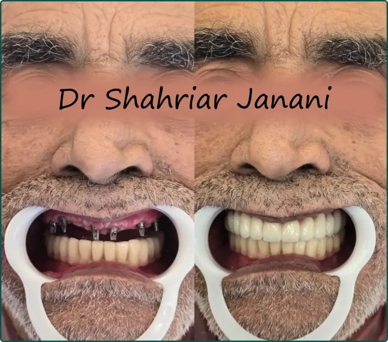 نمونه کار دکتر جنانی 2