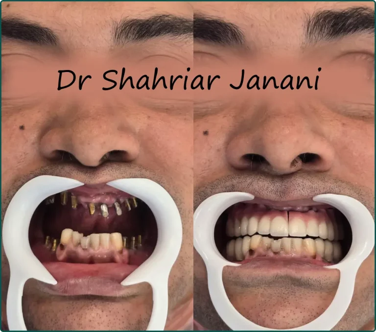 نمونه کار دکتر جنانی 3