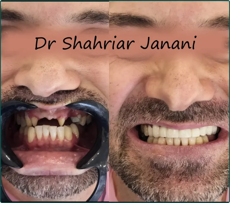 نمونه کار دکتر جنانی 4