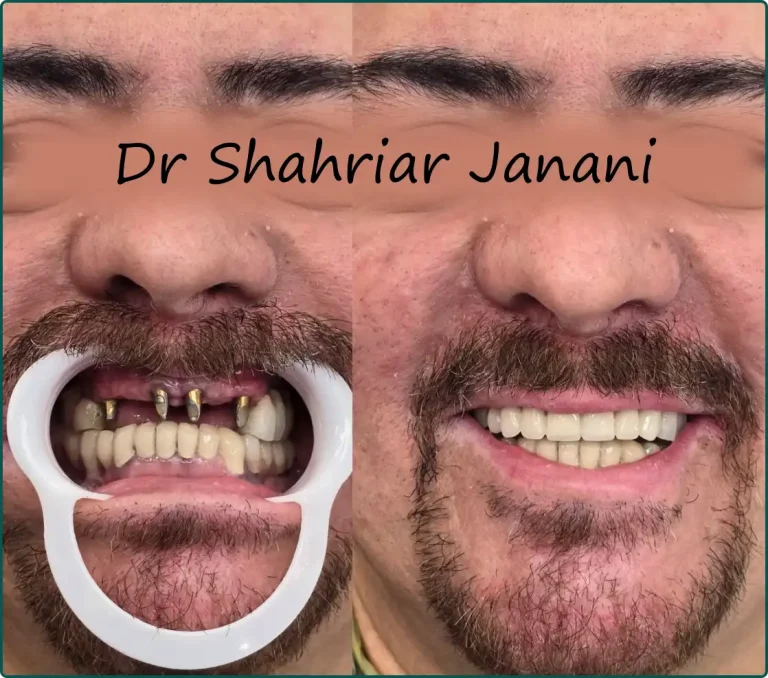 نمونه کار دکتر جنانی 5