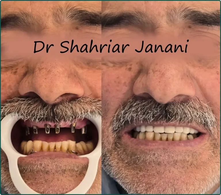 نمونه کار دکتر جنانی 6
