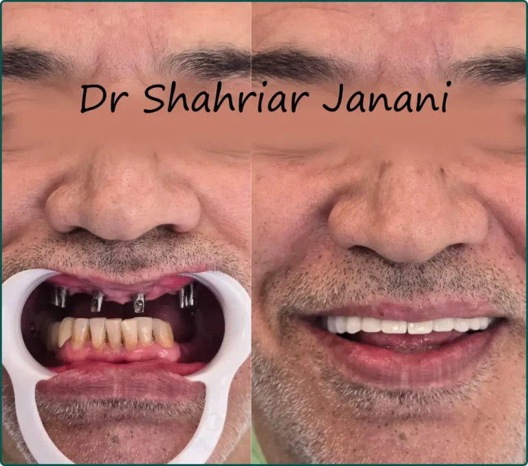 نمونه کار دکتر جنانی 8