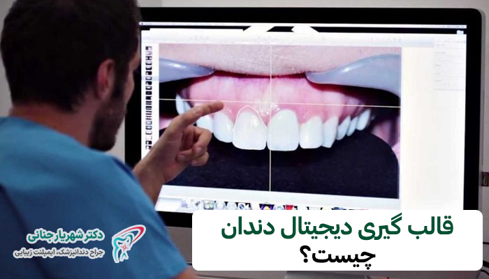 قالب گیری دیجیتال دندان در کرج چگونه انجام میشود؟