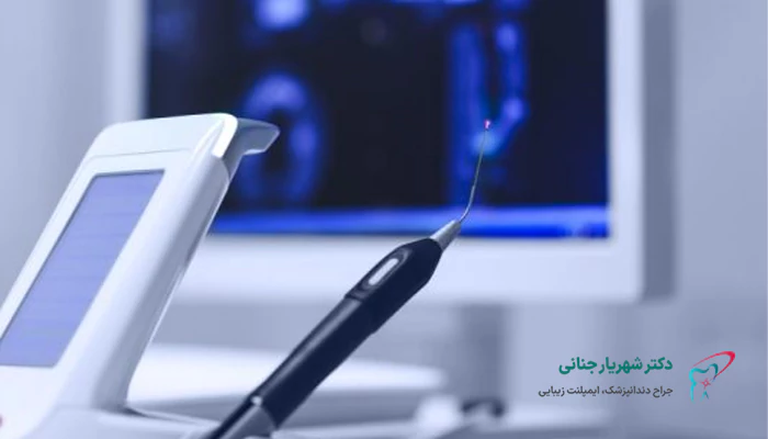 آیا ایمپلنت دندان لیزری همان ایمپلنت بدون جراحی است؟