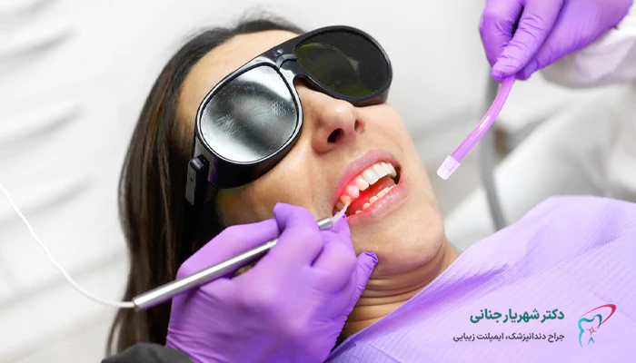 ایمپلنت دندان با لیزر بهتر است یا ایمپلنت به روش معمولی؟