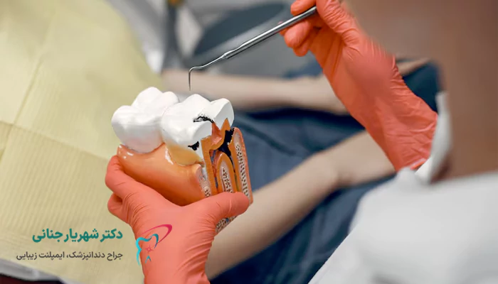 عصب کشی با لیزر برای چه کسانی مناسب است؟