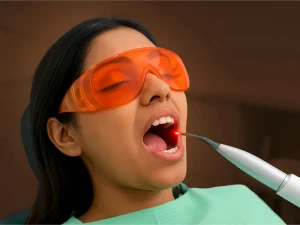 عصب کشی دندان با لیزر در کرج چگونه انجام میشود؟