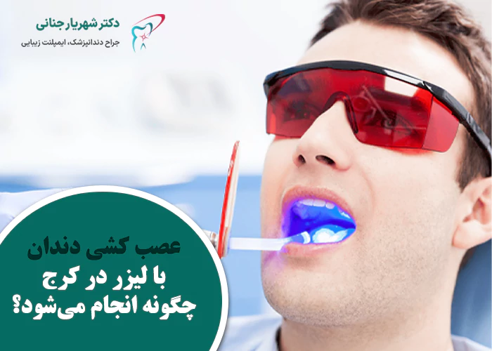 عصب کشی دندان با لیزر چگونه انجام میشود؟