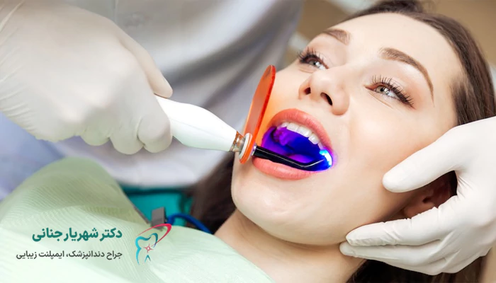 مراقبت های بعد از عصب کشی دندان با لیزر