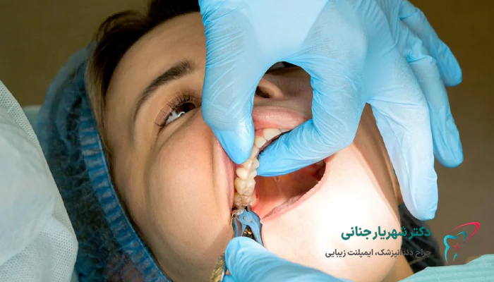 هزینه عصب کشی دندان با لیزر چقدر است؟