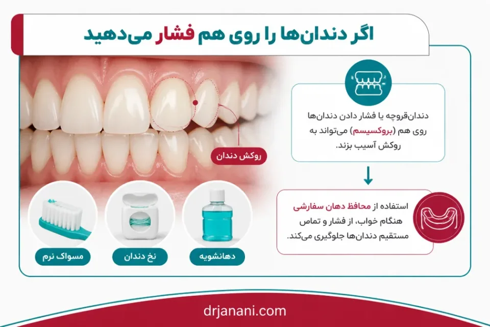 نمای توضیحی درباره اگر دندانها را روی هم فشار میدهید