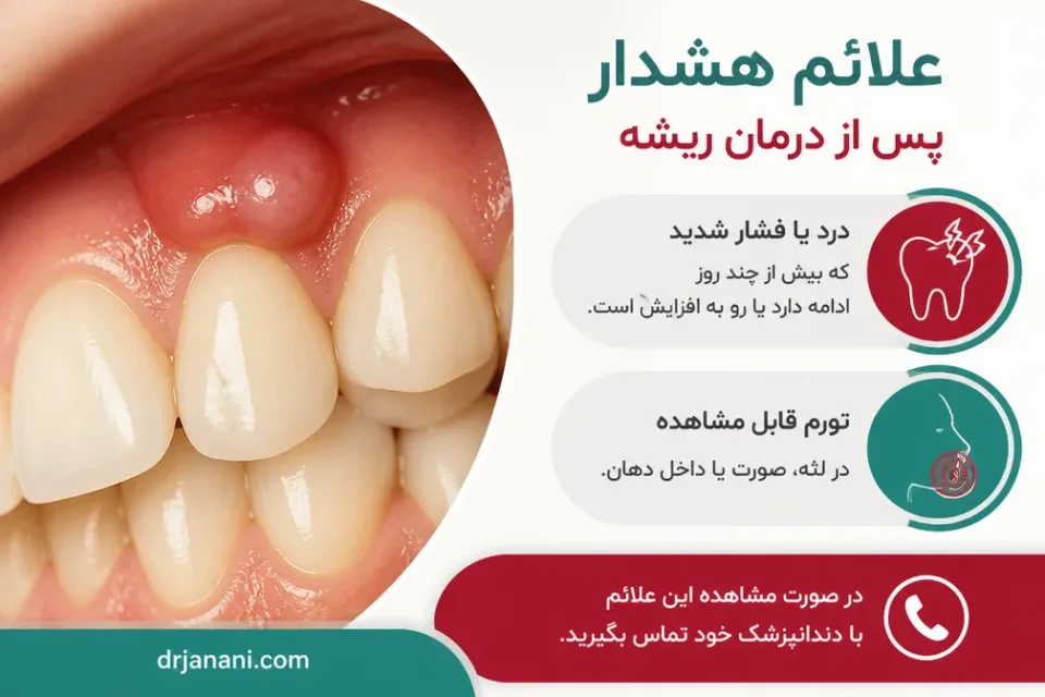 علائم هشدار پس از درمان ریشه — تورم لثه به عنوان علامت هشدار پس از درمان ریشه
