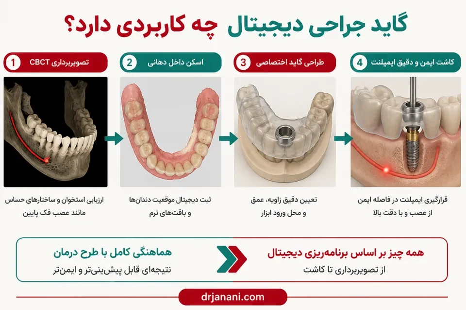 مراحل طراحی گاید جراحی برای محل کاشت ایمپلنت